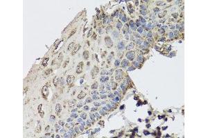 Immunohistochemistry of paraffin-embedded Human esophagus using GBF1 Polyclonal Antibody at dilution of 1:100 (40x lens).