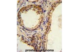 Immunohistochemistry (IHC) image for anti-CAMP Responsive Element Binding Protein 3-Like 1 (CREB3L1) antibody (ABIN3002703) (CREB3L1 antibody)