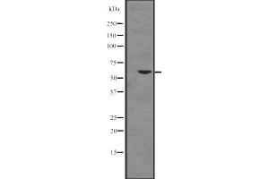 Western blot analysis of Cytochrome P450 17A1 expression in K562 cell line lysates ,The lane on the left is treated with the antigen-specific peptide.