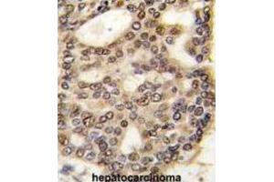 Immunohistochemistry (IHC) image for anti-Hepatoma-Derived Growth Factor (HDGF) antibody (ABIN3002632)