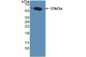 Detection of Recombinant PSMC1, Human using Polyclonal Antibody to Proteasome 26S Subunit, ATPase 1 (PSMC1) (PSMC1 antibody  (AA 1-440))