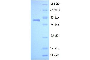 MPZ (AA 30-156), (partial) protein (GST tag)