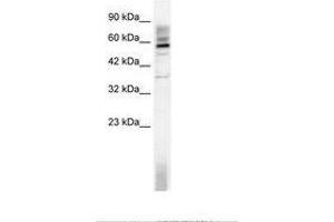 Image no. 1 for anti-TAF15 RNA Polymerase II, TATA Box Binding Protein (TBP)-Associated Factor, 68kDa (TAF15) (AA 183-232) antibody (ABIN202793) (TAF15 antibody  (AA 183-232))
