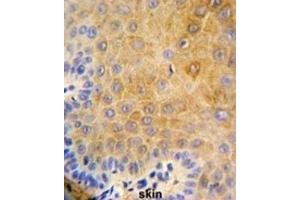 Immunohistochemistry (IHC) image for anti-Keratin 9 (KRT9) antibody (ABIN3003129) (KRT9 antibody)