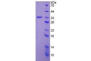 SDS-PAGE analysis of Human ADAM28 Protein. (ADAM28 Protein)