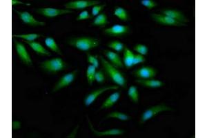 Immunofluorescence staining of Hela cells with ABIN7177987 at 1:100, counter-stained with DAPI. (ZAP7 (AA 253-325) antibody)