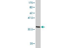 Western Blot detection against Immunogen (36. (LHX4 antibody  (AA 208-306))