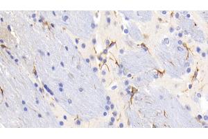 Detection of GFAP in Mouse Cerebrum Tissue using Monoclonal Antibody to Glial Fibrillary Acidic Protein (GFAP) (GFAP antibody  (AA 70-374))