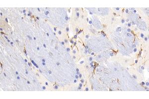 Detection of GFAP in Mouse Cerebrum Tissue using Monoclonal Antibody to Glial Fibrillary Acidic Protein (GFAP) (GFAP antibody  (AA 70-374))