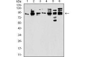 Western Blotting (WB) image for anti-DEAD (Asp-Glu-Ala-Asp) Box Polypeptide 20 (DDX20) (AA 725-824) antibody (ABIN5542507)