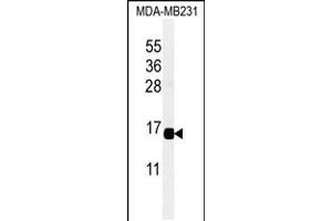 Western blot analysis of CXCL9 Antibody in MDA-MB231 cell line lysates (35ug/lane) (CXCL9 antibody  (C-Term))