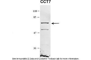 Sample Type: HEK 293 (10ug)Primary Dilution: 1:1000Secondary Antibody: conjugated goat anti-rabbitSecondary Dilution: 1:10,000Image Submitted By: Amy GrayBrigham Young University (CCT7 antibody  (Middle Region))