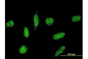 Immunofluorescence of monoclonal antibody to TOPORS on HeLa cell. (TOPORS antibody  (AA 98-205))