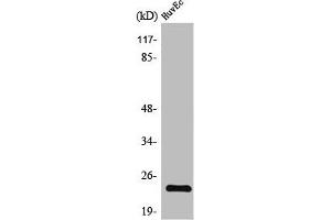 Western Blot analysis of HuvEc cells using TNF-IP 8 Polyclonal Antibody (TNFAIP8 antibody  (Internal Region))