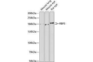 Western blot analysis of extracts of various cell lines, using RBP3 antibody (ABIN6129600, ABIN6146801, ABIN6146802 and ABIN6222034) at 1:1000 dilution. (RBP3 antibody  (AA 18-320))