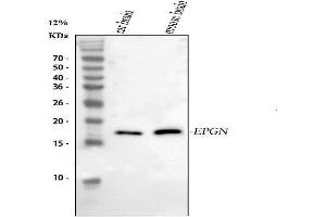 Western blot analysis of Epigen using anti-Epigen antibody (ABIN5518911).