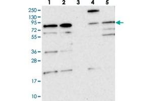 Western blot analysis of Lane 1: RT-4, Lane 2: U-251 MG, Lane 3: Human Plasma, Lane 4: Liver, Lane 5: Tonsil with KIAA1731 polyclonal antibody  at 1:250-1:500 dilution. (KIAA1731 (KIAA1731) antibody)