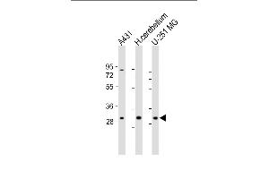 All lanes : Anti-BCDIN3D Antibody (C-Term) at 1:1000-2000 dilution Lane 1: A431 whole cell lysate Lane 2: human cerebellum lysate Lane 3: U-251 MG whole cell lysate Lysates/proteins at 20 μg per lane. (BCDIN3D antibody  (AA 243-276))