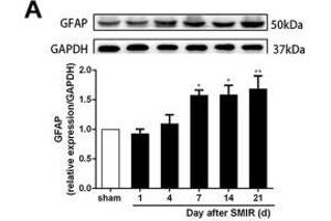 Astrocytes were activated and mainly expressed as the A1 phenotype in the spinal cord after SMIR. (GAPDH antibody)