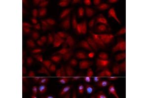 Immunofluorescence analysis of U2OS cells using PSMB5 Polyclonal Antibody (PSMB5 antibody)