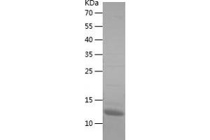 Western Blotting (WB) image for Laminin, gamma 2 (LAMC2) (AA 1084-1193) protein (His tag) (ABIN7283626) (LAMC2 Protein (AA 1084-1193) (His tag))