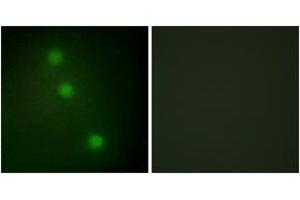 Immunofluorescence analysis of HuvEc cells, using ATF1 Antibody. (AFT1 antibody  (AA 176-225))