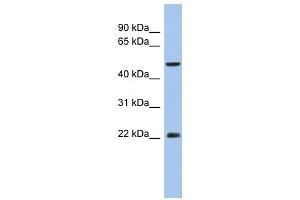 ANKH antibody used at 1 ug/ml to detect target protein. (ANKH antibody)