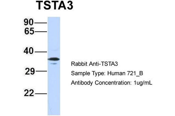 TSTA3 Antikörper  (N-Term)