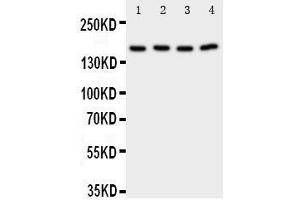 Anti-Phospholipase A2 antibody, Western blotting Lane 1: Rat Testis Tissue Lysate Lane 2: Rat Brain Tissue Lysate Lane 3: A549 Cell Lysate Lane 4: COLO320 Cell Lysate
