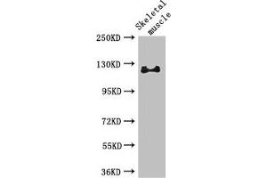Western Blot Positive WB detected in: Mouse skeletal muscle tissue All lanes: RBL1 antibody at 3 μg/mL Secondary Goat polyclonal to rabbit IgG at 1/50000 dilution Predicted band size: 121, 115 kDa Observed band size: 121 kDa