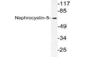 Western blot (WB) analysis of Nephrocystin-5 antibody in extracts from K562 cells.
