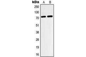 Western blot analysis of HIF3 alpha expression in HeLa (A), HepG2 (B) whole cell lysates. (HIF3A antibody  (Center))