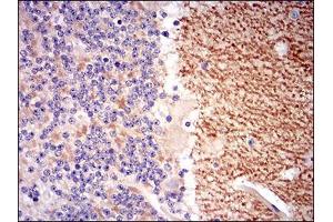 Immunohistochemical analysis of paraffin-embedded cerebellum tissues using GABBR2 mouse mAb with DAB staining. (GABBR2 antibody  (AA 319-483))