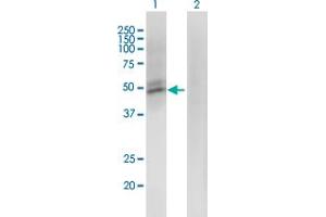 Western Blot analysis of ACMSD expression in transfected 293T cell line by ACMSD monoclonal antibody (M01), clone 3A9.