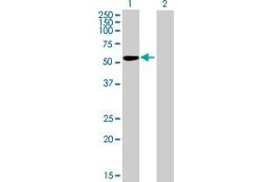 Western Blot analysis of IGSF21 expression in transfected 293T cell line by IGSF21 MaxPab polyclonal antibody. (IGSF21 antibody  (AA 1-467))