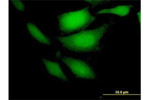 Immunofluorescence of purified MaxPab antibody to CDKN2C on HeLa cell.