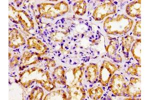 Immunohistochemistry of paraffin-embedded human kidney tissue using ABIN7161906 at dilution of 1:100 (NR2F6 antibody  (AA 6-194))