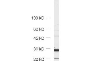 Western Blotting (WB) image for anti-Tumor Protein P63 Regulated 1-Like (TPRG1L) antibody (ABIN1742502) (TPRG1L antibody)