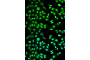 Immunofluorescence analysis of HeLa cells using CDKN2D antibody (ABIN5973935).