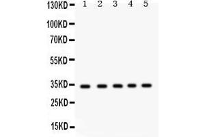 Western Blotting (WB) image for anti-Estrogen Receptor Binding Site Associated, Antigen, 9 (EBAG9) (AA 31-213) antibody (ABIN3043569)