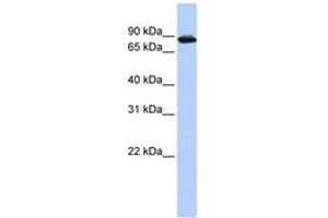 Image no. 1 for anti-HIV-1 Tat Specific Factor 1 (HTATSF1) (AA 612-661) antibody (ABIN6744230) (HTATSF1 antibody  (AA 612-661))