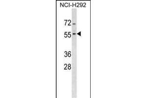 ZN Antibody (Center) (ABIN1537992 and ABIN2849203) western blot analysis in NCI- cell line lysates (35 μg/lane).