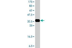 Western Blot detection against Immunogen (34. (LHX2 antibody  (AA 1-76))