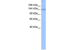 WB Suggested Anti-COPA Antibody Titration: 0. (COPA antibody  (N-Term))