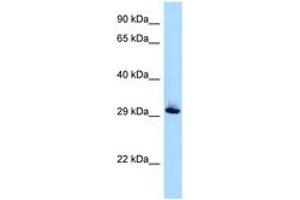 Image no. 1 for anti-RAB33B, Member RAS Oncogene Family (RAB33B) (AA 80-129) antibody (ABIN6747936)