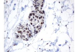 Image no. 1 for anti-Methyltransferase Like 16 (METTL16) antibody (ABIN1499432) (METTL16 antibody)