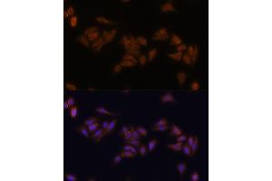 Immunofluorescence analysis of U-2 OS cells using RPS17 antibody (ABIN7270016) at dilution of 1:100. (RPS17 antibody  (AA 1-100))