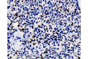 Immunohistochemistry analysis of paraffin-embedded rat spleen using ERK 2 Polyclonal Antibody at dilution of 1:100. (ERK2 antibody)