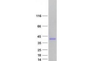 Validation with Western Blot