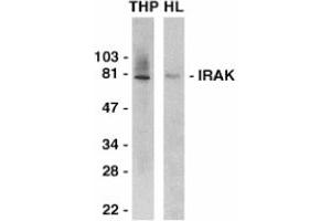 Image no. 1 for anti-Interleukin-1 Receptor-Associated Kinase 1 (IRAK1) (C-Term) antibody (ABIN201163)